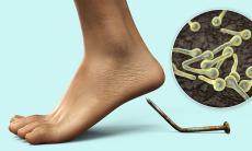 Vaccin antitetanos – cand se face si cat timp este valabil