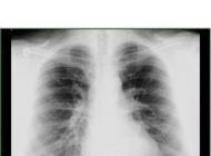 Radiografie