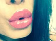 Marire buze cu acid hialuronic Princess